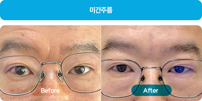 쥬브젠비포애프터2