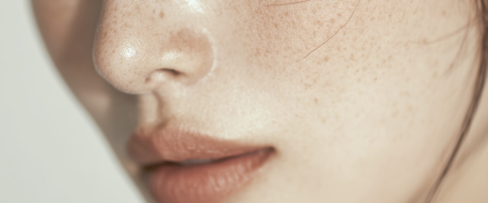 기미 색소 정의 이미지