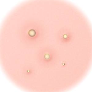 여드름포인트 이미지1