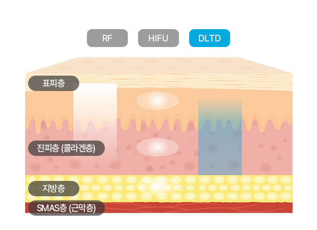 올타이트포인트 이미지2