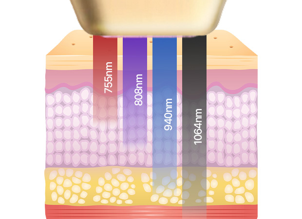 포트라 콰트로포인트 이미지1