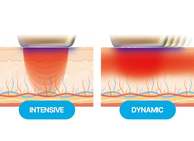 포트라 콰트로포인트 이미지2