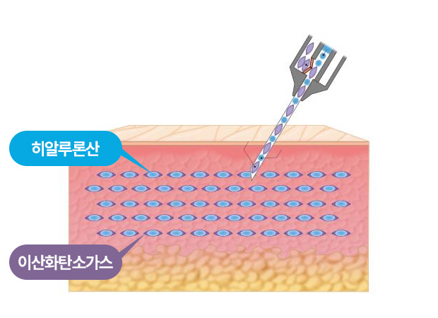 쥬브젠포인트 이미지1
