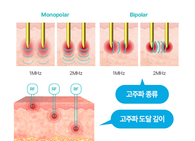 포텐자포인트 이미지2
