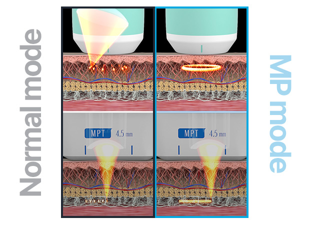 슈링크유니버스포인트 이미지1