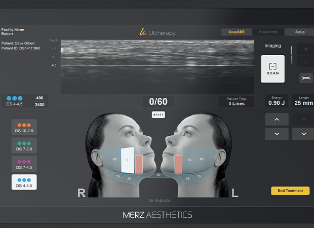 울쎄라피프라임포인트 이미지3