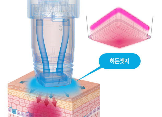 볼뉴머포인트 이미지1