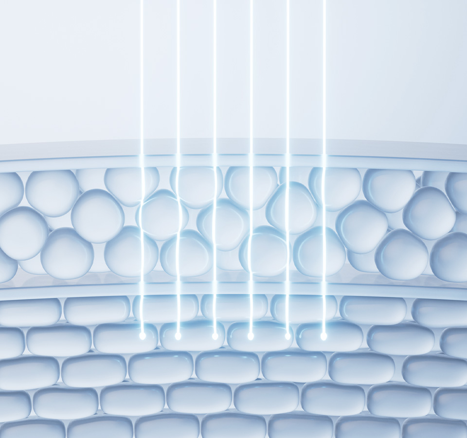 포트라 콰트로추천대상 이미지